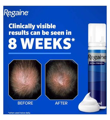 Regaine for Men Extra Strength Scalp Foam 5% w/w Cutaneous Foam - 3 Months Supply