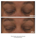 StriVectin Hyaluronic Tripeptide Gel-Cream for Eyes