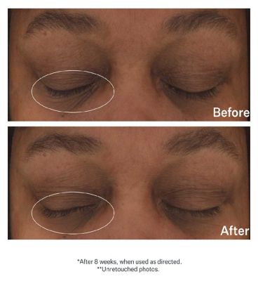 StriVectin Hyaluronic Tripeptide Gel-Cream for Eyes