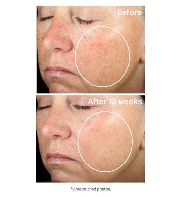 StriVectin Super-C Retinol Brightening & Correcting Serum