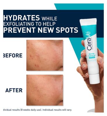 CeraVe Blemish Control Gel Moisturiser with 2% Salicylic Acid & Niacinamide for Blemish-Prone Skin 40ml
