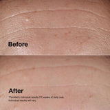 Clinique Smart Clinical Repair™ Wrinkle Correcting Serum 100ml