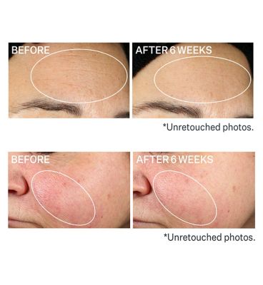 StriVectin Super-B Barrier Strengthening Oil