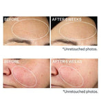 StriVectin Super-B  Barrier Strengthening Oil