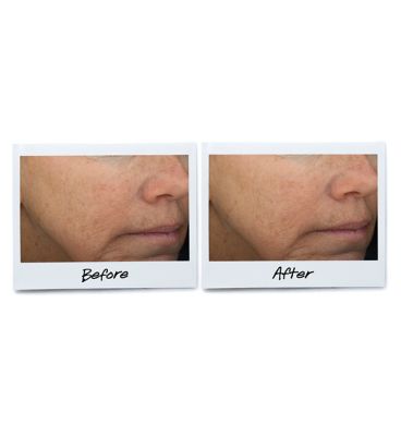 Kiehl's Powerful-Strength Line-Reducing Concentrate 100ml&nbsp;