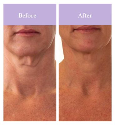 PRAI Beauty Ageless Throat & Decolletage Creme 50ml