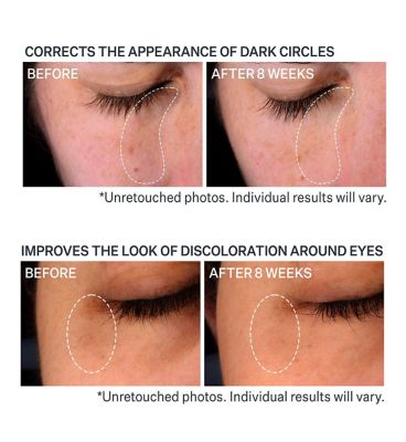 StriVectin Super-C Dark Circle Brightening Eye Serum 15ml