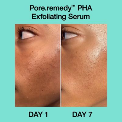 Dr.Jart+ Pore Remedy™ PHA Exfoliating Serum 30ml