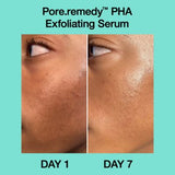 Dr.Jart+ Pore Remedy™ PHA Exfoliating Serum 30ml