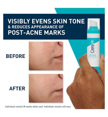 CeraVe Resurfacing Retinol Serum with Ceramides & Niacinamide for Blemish-Prone Skin 30ml