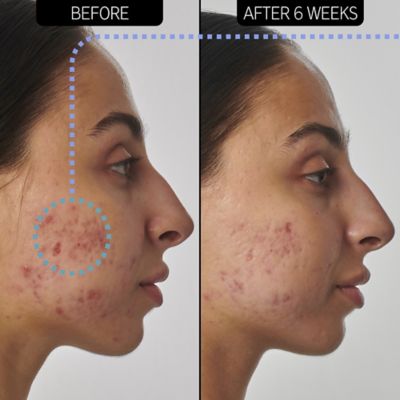 The INKEY List™ SuperSolutions 1% Retinol Serum 30ml