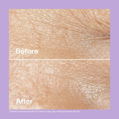 Clinique Smart Clinical Repair™ Wrinkle Correcting Rich Cream 50ml