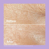 Clinique Smart Clinical Repair™ Wrinkle Correcting Rich Cream 50ml