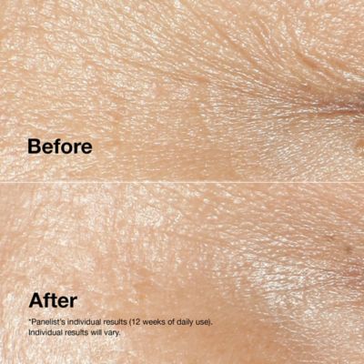 Clinique Smart Clinical Repair™ Wrinkle Correcting Cream All Skin Types 50ml