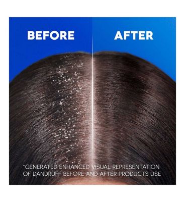 Head & Shoulders Smooth & Silky Anti-Dandruff Shampoo for Frizzy Hair 400ml