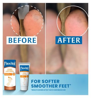 Flexitol Intensely Nourishing Foot Cream 145g