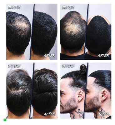 MR. Jamie Stevens Medium Brown Keratin Hair Fibres 15g