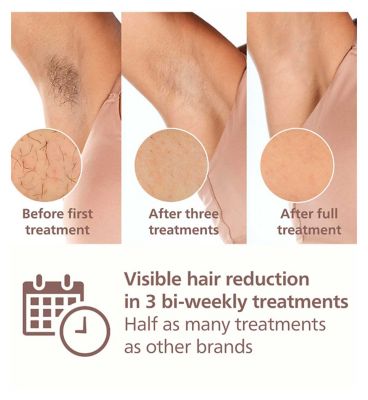 Philips Lumea 8000 Series, IPL Hair Removal Device with Pen Trimmer, 4 Attachments for Body, Face, Bikini & Underarms, BRI949/00