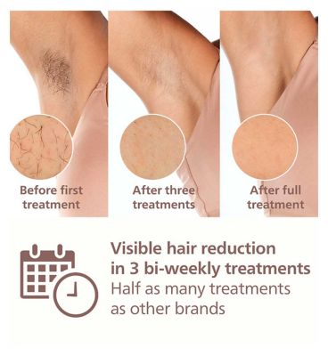 Philips Lumea 8000 Series, IPL Hair Removal Device, SenseIQ Technology, 2 Attachments for Body and Face, BRI945/00