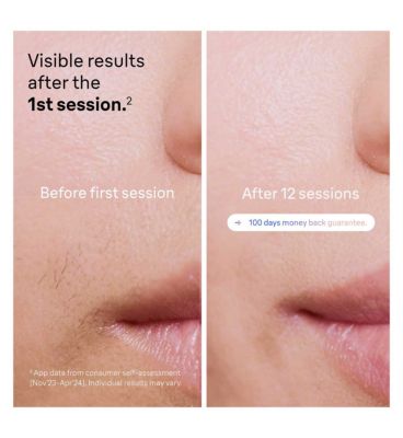 Braun Skin i·expert, Smart IPL Hair Removal System With Connected App & 4 Attachment Caps - PL7387