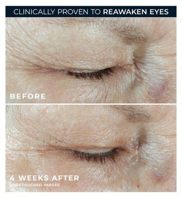 RoC Multi Correxion Hydrate + Plump Eye Cream with Caffeine and Hyaluronic Acid for Dark Circles and Puffy Eyes 15ml
