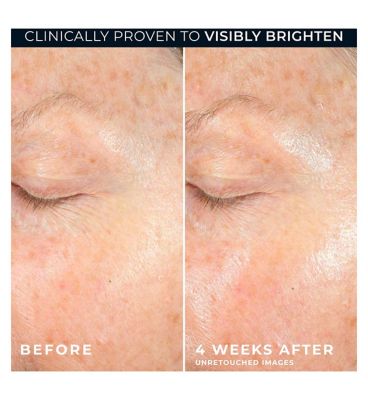 RoC Multi Correxion Revive + Glow Vitamin C Gel Cream, Skin Plumping and Brightening, 50ml