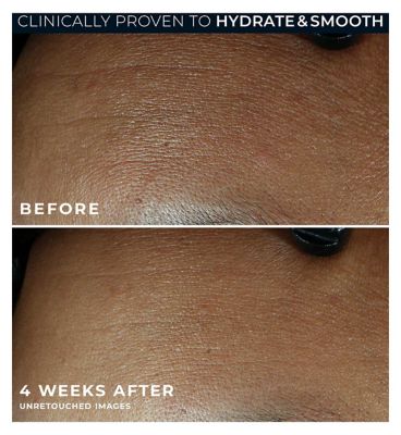 RoC Retinol Correxion Line Smoothing Max Hydration Cream, Intensive Anti-Wrinkle & Anti-Aging Moisturiser 50ml
