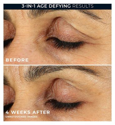 RoC Retinol Correxion Line Smoothing Eye Cream to Reduce Puffiness & Dark Circles,15ml