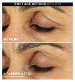RoC Retinol Correxion Line Smoothing Eye Cream to Reduce Puffiness & Dark Circles,15ml