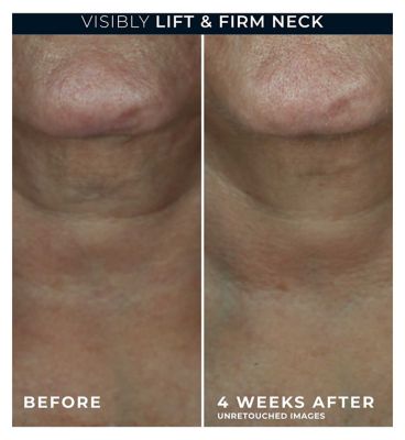 RoC Derm Correxion Retinol Contour Cream for Face, Neck & Jawline, Visible Facelift 50ml