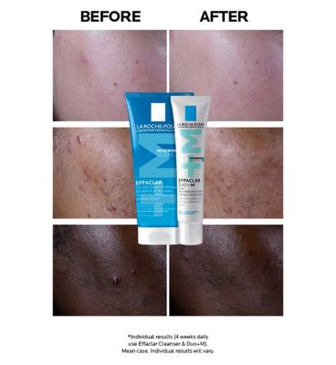 La Roche-Posay Effaclar Duo+M: Anti-Breakout Corrective Gel Moisturiser 40ml