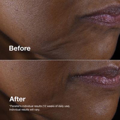 Clinique Smart Clinical Repair™ Lifting Face + Neck Cream 50ml