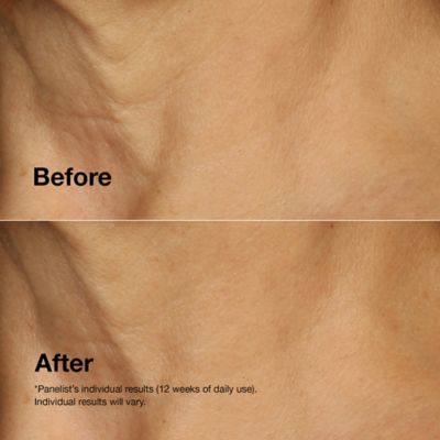 Clinique Smart Clinical Repair™ Lifting Face + Neck Cream 50ml