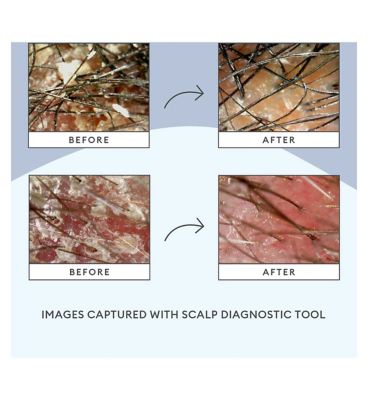 Briogeo Scalp Revival™ Charcoal + Tea Tree Scalp Treatment 30ml