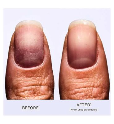 OPI Nail Envy Original 15ml