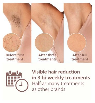 Philips Lumea 9000 Series, IPL Hair Removal Device, 3 Attachments for Body, Face & Precision Areas, Corded & Cordless, BRI955/01