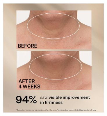 STRIVECTIN TL Advanced Tightening Neck Cream PLUS