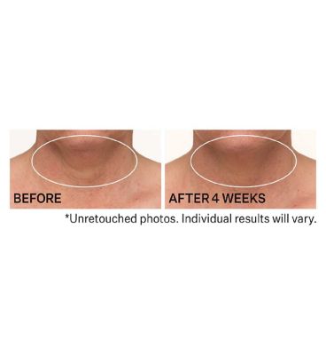 STRIVECTIN TL Advanced Tightening Neck Cream PLUS