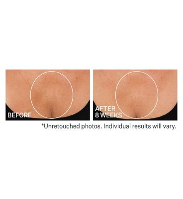 STRIVECTIN TL Advanced Tightening Neck Cream PLUS