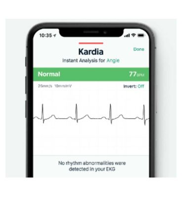 Alivecor KardiaMobile Single Lead ECG Monitor