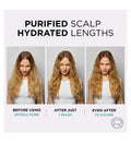L’Oréal Paris Elvive Hydra Pure Exfoliating Pre-Shampoo Scalp Serum for Oily Scalp & Roots 102ml