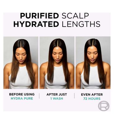 L’Oréal Paris Elvive Hydra Pure Exfoliating Pre-Shampoo Scalp Serum for Oily Scalp & Roots 102ml