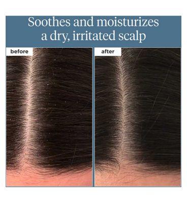 Briogeo Scalp Revival™ Rosemary Pre-Wash Oil for Hair and Scalp