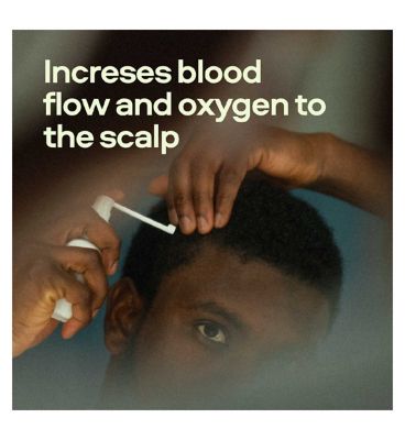 Sons Minoxidil 5% Cutaneous Solution 3 x 60ml