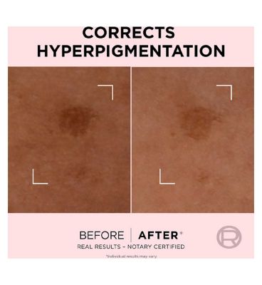 L'Oréal Paris Age Perfect Golden Age Rapid Spot Corrector Niacinamide 50ml