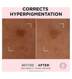 L'Oréal Paris Age Perfect Golden Age Rapid Spot Corrector Niacinamide 50ml