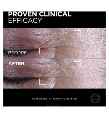 L'Oréal Paris Age Perfect Cell Renew Midnight Eye Cream Antioxidant Recovery Complex 15ml