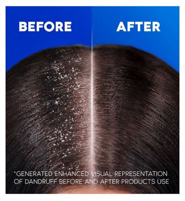 Head & Shoulders Citrus Fresh 2in1 Anti Dandruff Shampoo for greasy hair 330ml. Daily use