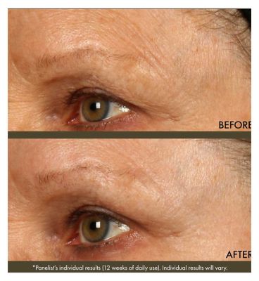 Origins Plantscription™ Active Wrinkle Correction Serum 30ml