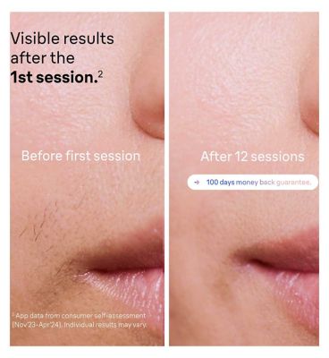 Braun Smart IPL Skin i·expert, At Home Hair Removal, Pouch, Venus Razor, 2 Heads, PL7147